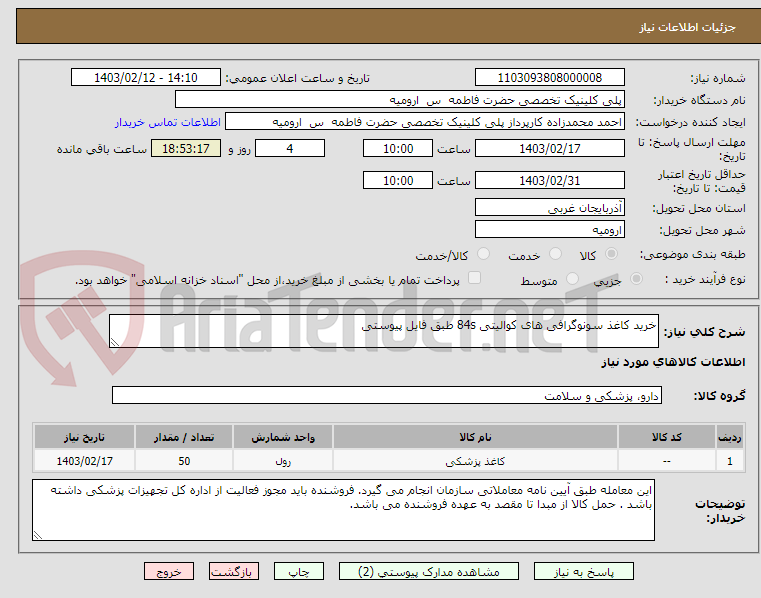 تصویر کوچک آگهی خرید کاغذ سونوگرافی های کوالیتی 84s طبق فایل پیوستی