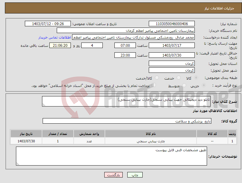 تصویر کوچک آگهی نیاز انتخاب تامین کننده-تابلو دید دیجیتالی جهت بینایی سنجی(چارت بینایی سنجی)
