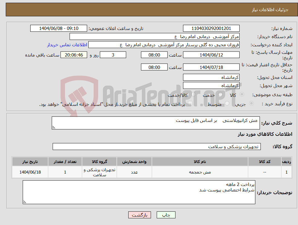 تصویر کوچک آگهی نیاز انتخاب تامین کننده- مش کرانیوپلاستی بر اساس فایل پیوست 
