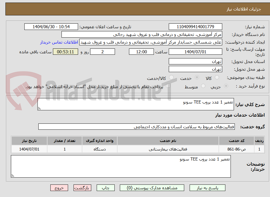 تصویر کوچک آگهی تعمیر 1 عدد پروب TEE سونو