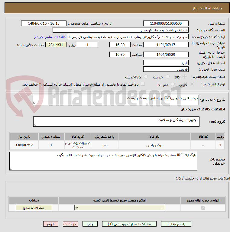 تصویر کوچک آگهی درن بطنی خارجیEVD-بر اساس لیست پیوست