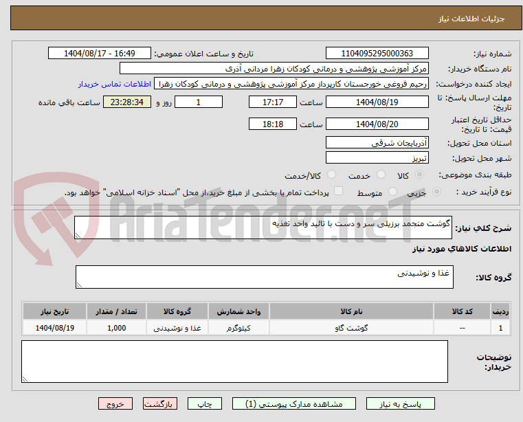 تصویر کوچک آگهی گوشت منجمد برزیلی سر و دست با تائید واحد تغذیه