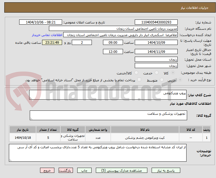 تصویر کوچک آگهی پروپ ویترکتومی