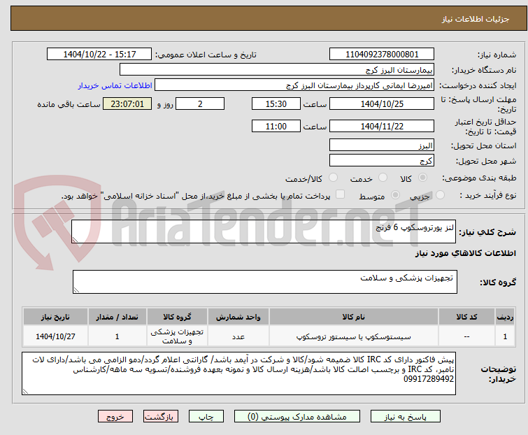 تصویر کوچک آگهی لنز یورتروسکوپ 6 فرنج