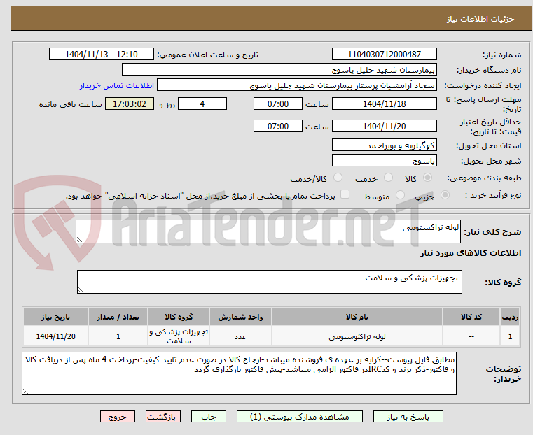 تصویر کوچک آگهی لوله تراکستومی