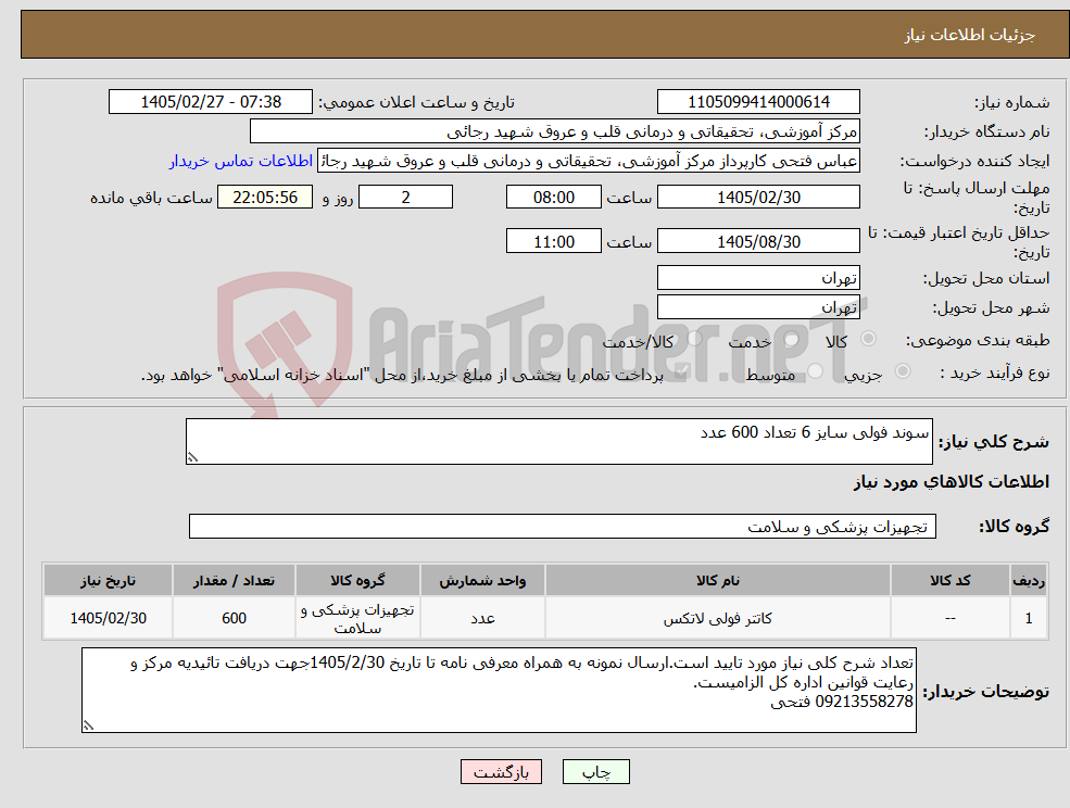 تصویر کوچک آگهی نیاز کالا-سوند فولی سایز 6 تعداد 600 عدد 